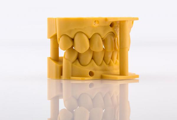 EvoDent Model V2.0 jaune - exemple de modele dentaire imprime